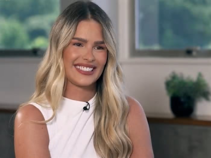 Yasmin Brunet abre o jogo sobre o impacto do lipedema: 