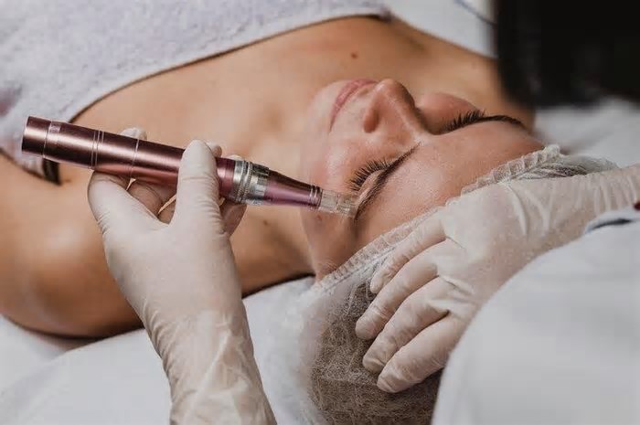 Anvisa flagra clínica de estética em BH reutilizando instrumento de microagulhamento sujo de sangue