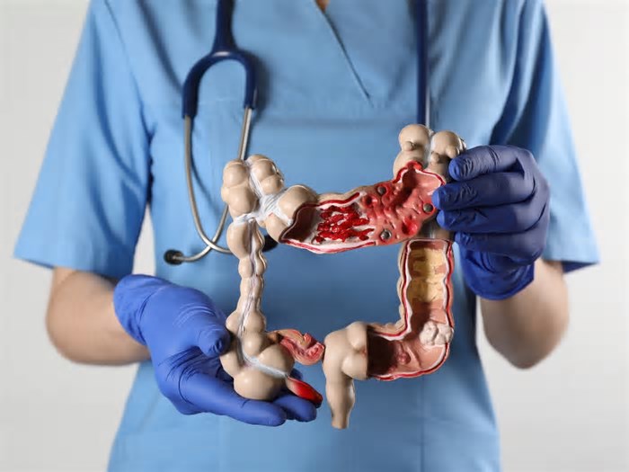 Ministério da Saúde inclui transplante de intestino delgado e multivisceral no SUS