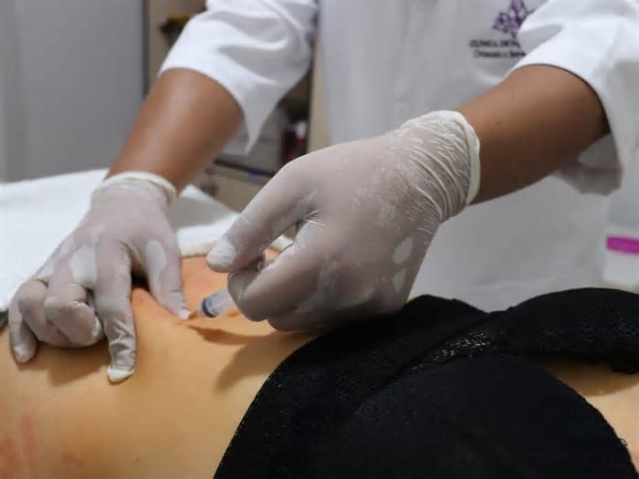 Anvisa fecha 8 clínicas de estética após fiscalização; em BH, foram 3 estabelecimentos interditados