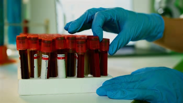 IA pode estimar a idade biológica de uma pessoa a partir de apenas cinco gotas de sangue