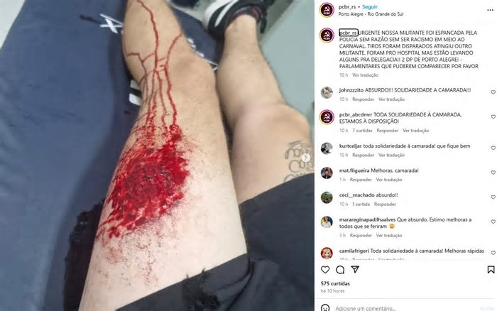 PCBR denuncia que militante foi espancada durante operação da BM para conter Carnaval na Cidade Baixa