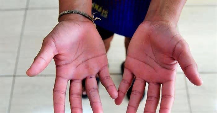 Após a enchente, aumentam os registros de trabalho infantil em Porto Alegre