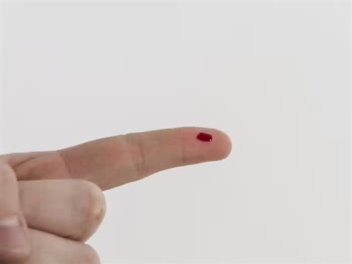 Inteligência artificial pode estimar idade biológica de uma pessoa a partir de cinco gotas de sangue