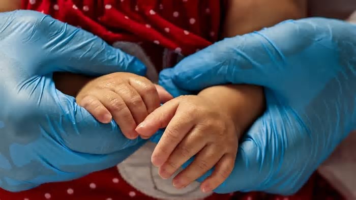 SUS passa a oferecer tratamento inovador de atrofia muscular espinhal