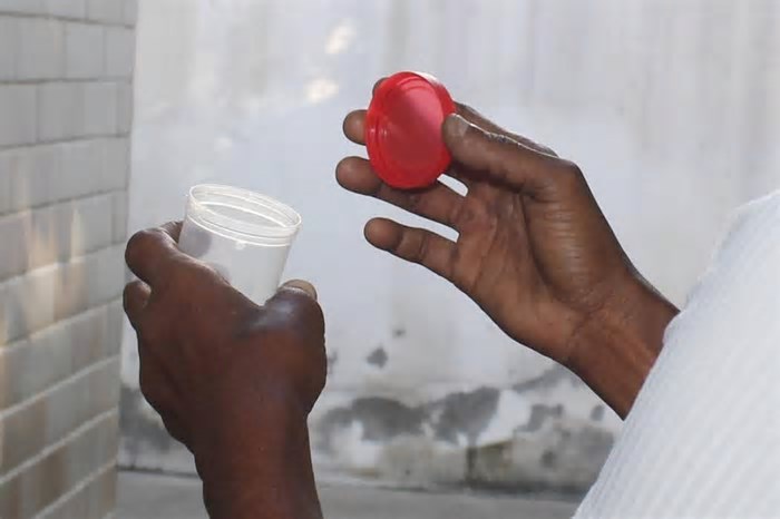 Com 130 casos em 2024, Saúde de Piracicaba inicia busca ativa por novos casos de tuberculose