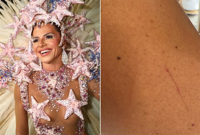 Carnaval 2025: Musa da Grande Rio mostra marcas e arranhões no corpo após o desfile