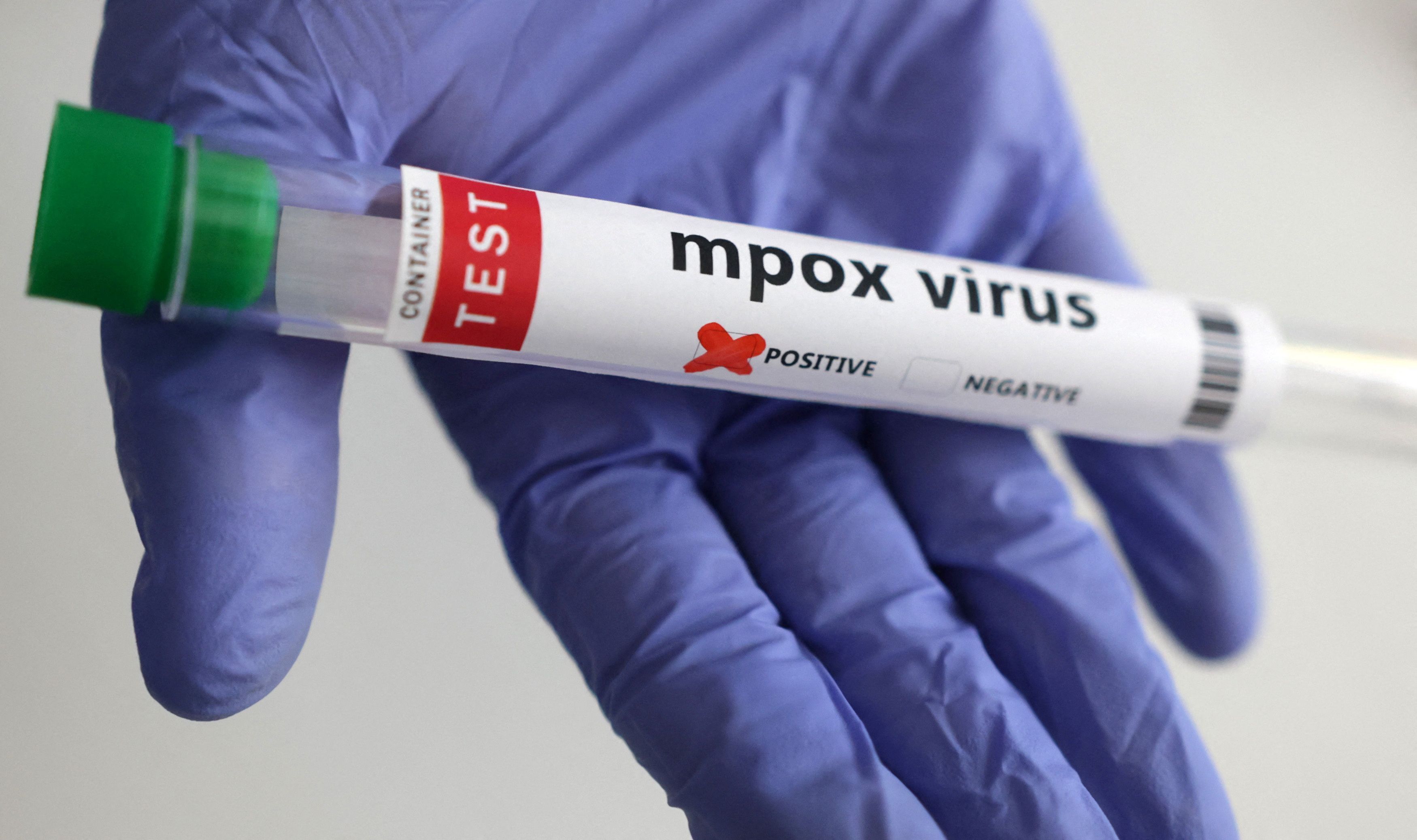 São Paulo registra primeiro caso de nova cepa de mpox no Brasil; não há casos secundários