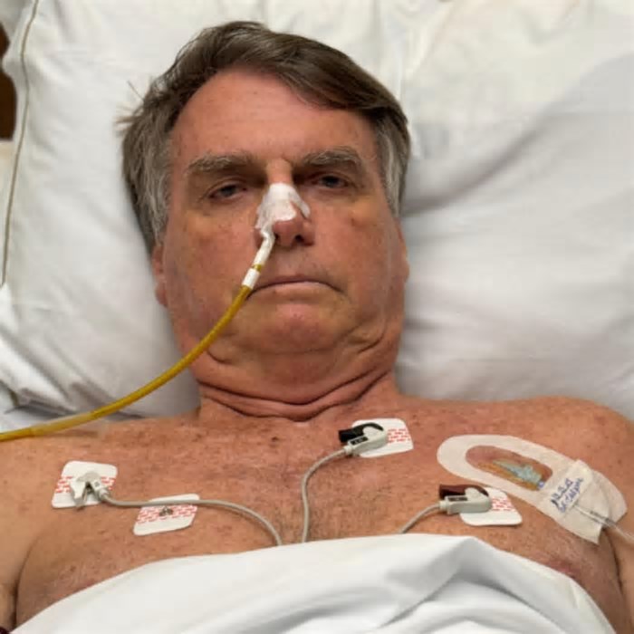 Bolsonaro ainda não tem movimentos intestinais espontâneos