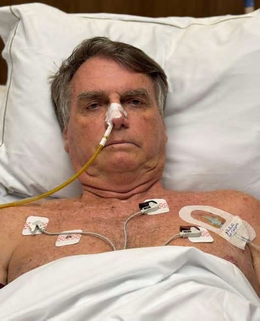 Bolsonaro apresenta melhora em estado de saúde e deixa UTI após 17 dias de cirurgia