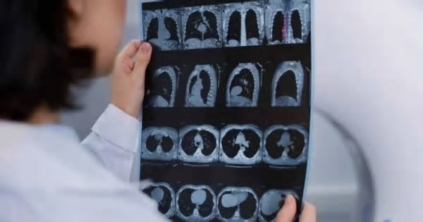 Algoritmo identifica falhas em tumores e promete transformar o tratamento do câncer