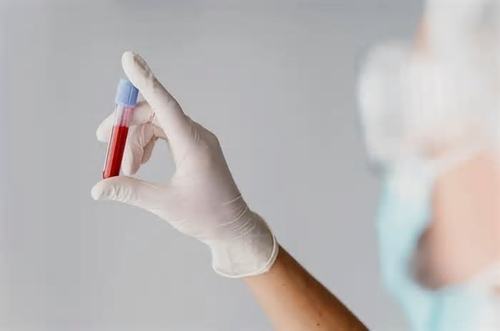 Novo exame de sangue usa IA para detectar até 12 tipos de câncer