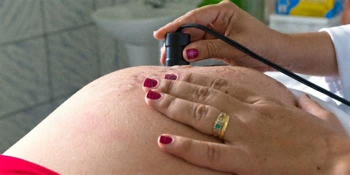 Dia Mundial da Saúde: campanha defende bem-estar materno e neonatal