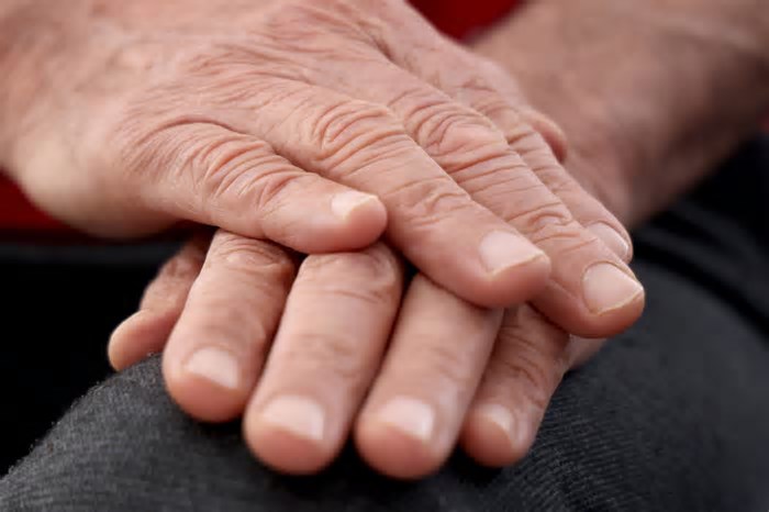 Conheça 4 alterações nas unhas que podem indicar problemas de saúde