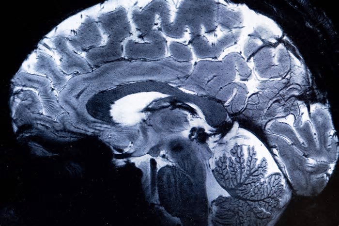 Como seu cérebro cria novas memórias? Pesquisa propõe como neurônios codificam novas informações