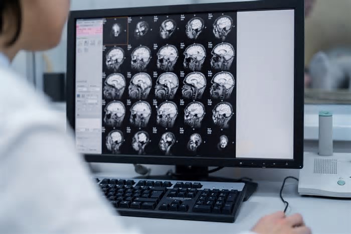 IA na oncologia, presente e futuro