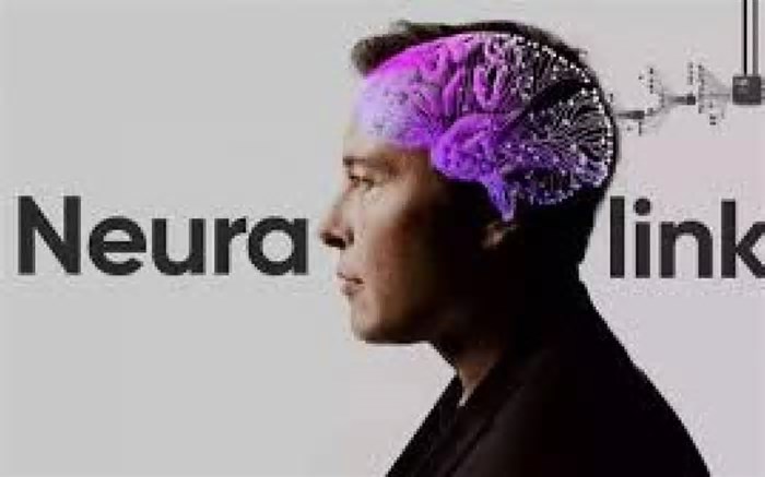 Neuralink procura voluntários ao redor do mundo para implante de chip cerebral
