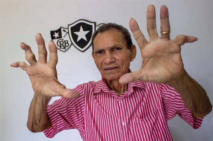 Ex-Operário, lendário goleiro Manga morre aos 87 anos