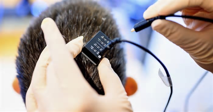 Implante cerebral transforma pensamentos em fala quase em tempo real