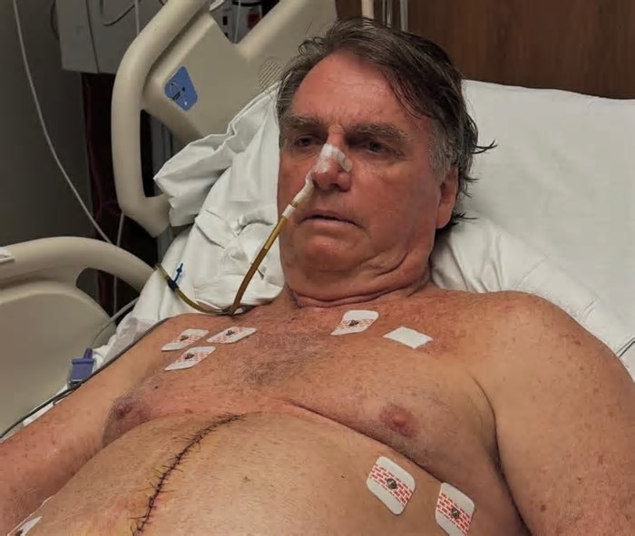 Ex-presidente Jair Bolsonaro faz publicação nas redes sociais sobre o seu estado de saúde: “Fase de recuperação”