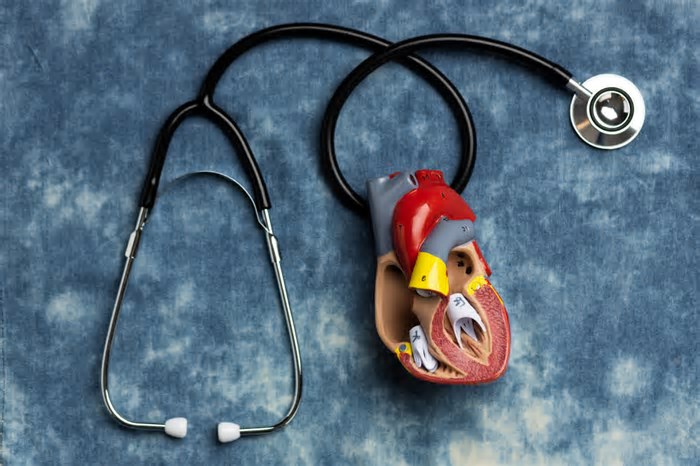 Como a trombectomia e a inteligência artificial estão transformando o tratamento do AVC