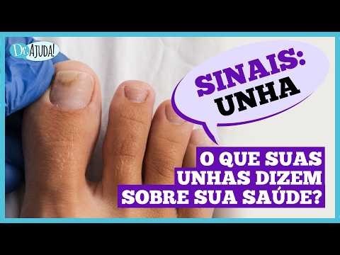 Dr. Ajuda: Unhas fracas podem indicar problemas de saúde