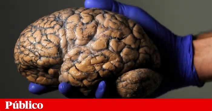 Cientistas procuram descobrir onde fica a consciência no nosso cérebro