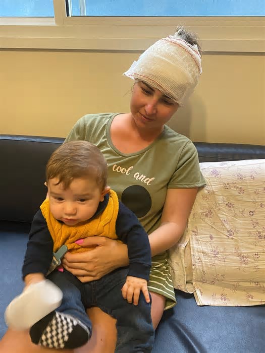 Brasileira passa por terapia pioneira em Curitiba após reaparecimento de tumor cerebral raro