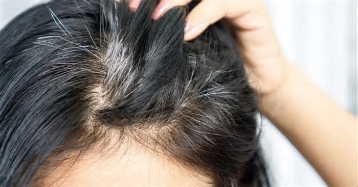 Cabelo branco nunca mais: Tinta caseira com 2 ingredientes reverte o grisalho das 60+