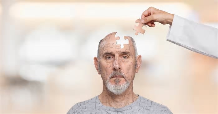 Inteligência artificial aponta possível tratamento para Alzheimer