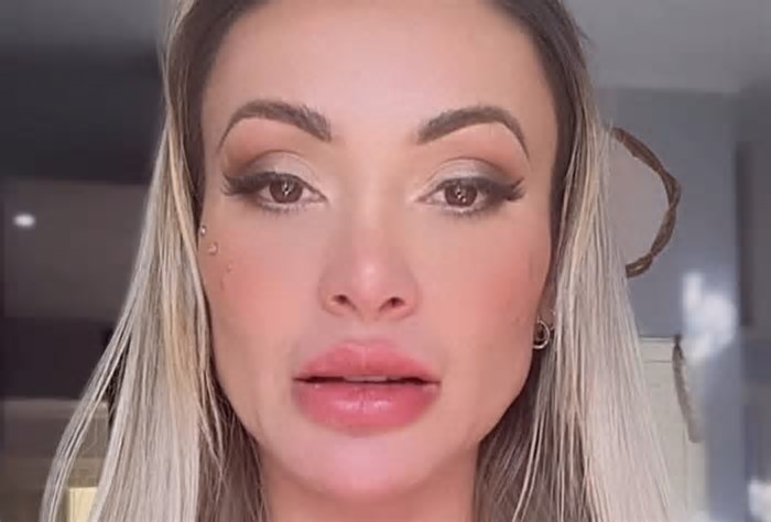 Andressa Urach faz desabafo sobre saúde mental: 'Sem forças e não posso me internar'