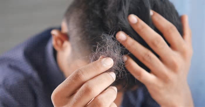 hCRP Sonicato per la caduta dei capelli: come la tecnologia fa evolvere il metodo PRP