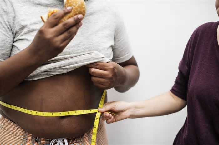 Desafios da obesidade no SUS é tema de debate na Academia Nacional de Medicina, no Rio