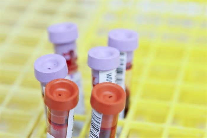 Ainda são muito caros: exames de sangue que testam 'idade' de órgãos prometem salto na medicina preventiva