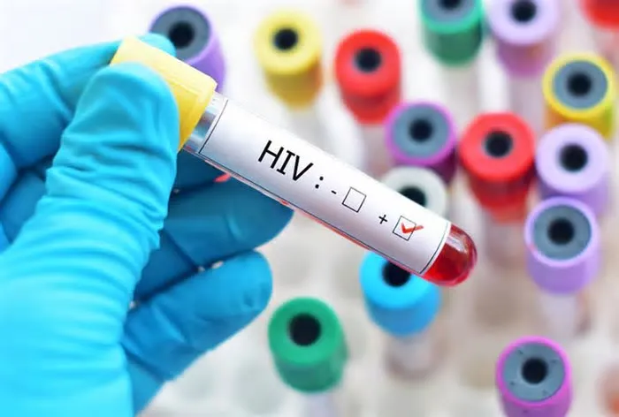 Os fundos destinados à distribuição de preservativos, essenciais contra a propagação do HIV, despencaram 90%, segundo o ...